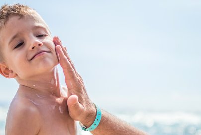 Comprendre les coups de soleil