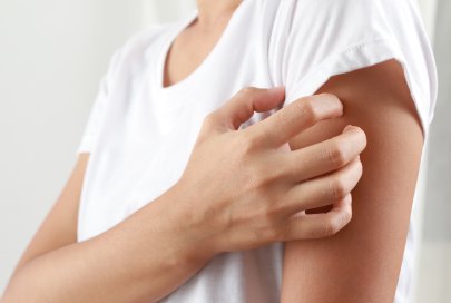 Les Causes de l’eczéma : Identifier les risques 