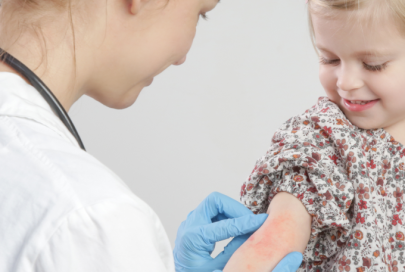 Eczéma traitement : comment traiter et soulager l’eczéma