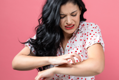 Eczéma de contact : ce qu’il faut savoir