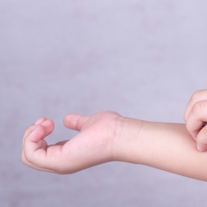 Le psoriasis est une inflammation de la peau