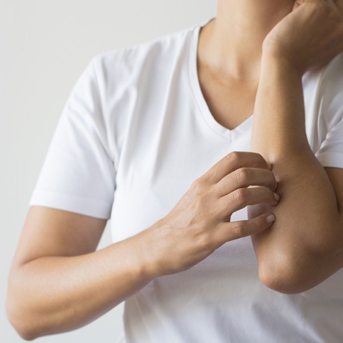 Une peau atopique s’exprime sous différentes formes, cela peut être par un eczéma, de l’asthme, ainsi que d’autre pathologies cutanées.