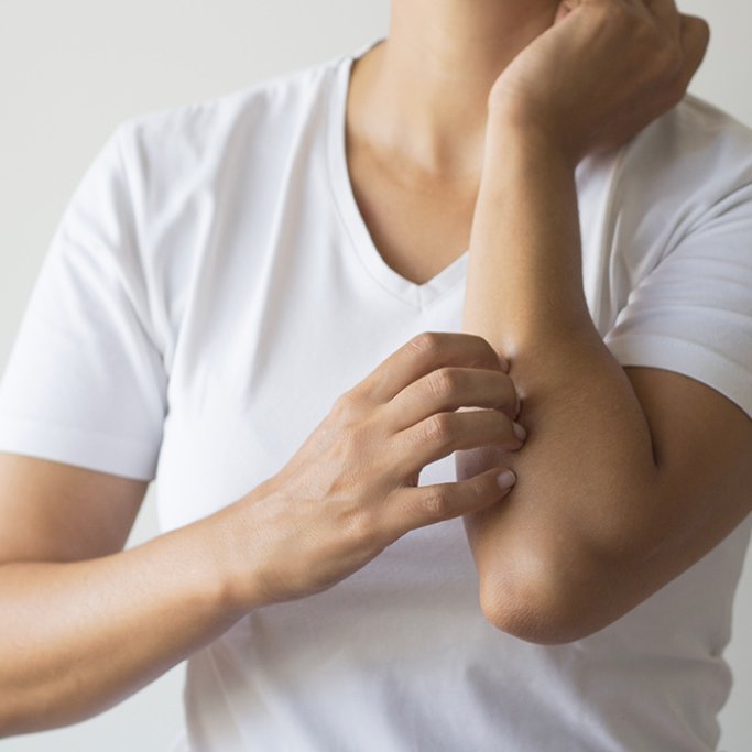 Une peau atopique s’exprime sous différentes formes, cela peut être par un eczéma, de l’asthme, ainsi que d’autre pathologies cutanées.