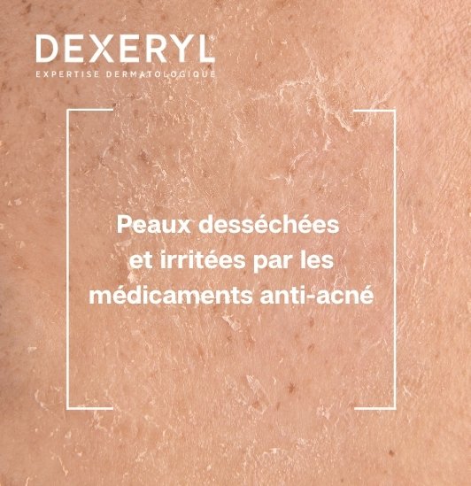 Crème hydratante réparatrice
