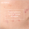 Gel moussant  Anti-Imperfections