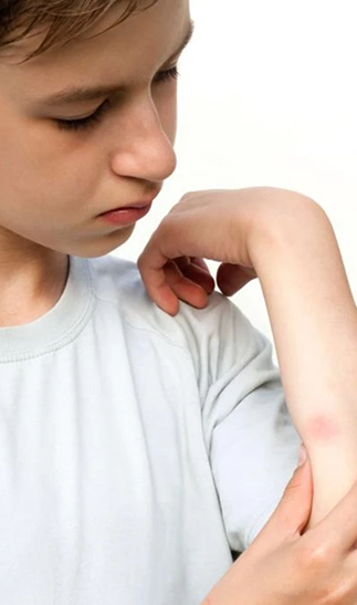 garçon insepctant un rougeur sur son avant bras gauche