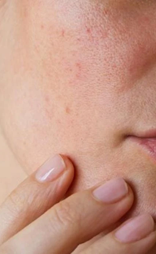 femme se touchant le visage